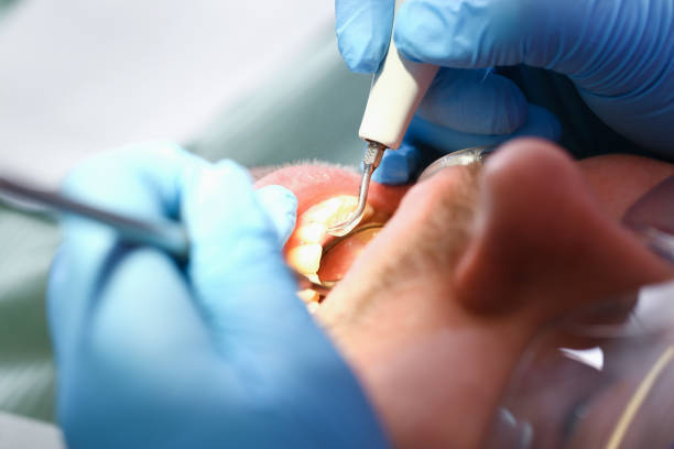 Best Pediatric Emergency Dentist in Burley, WA